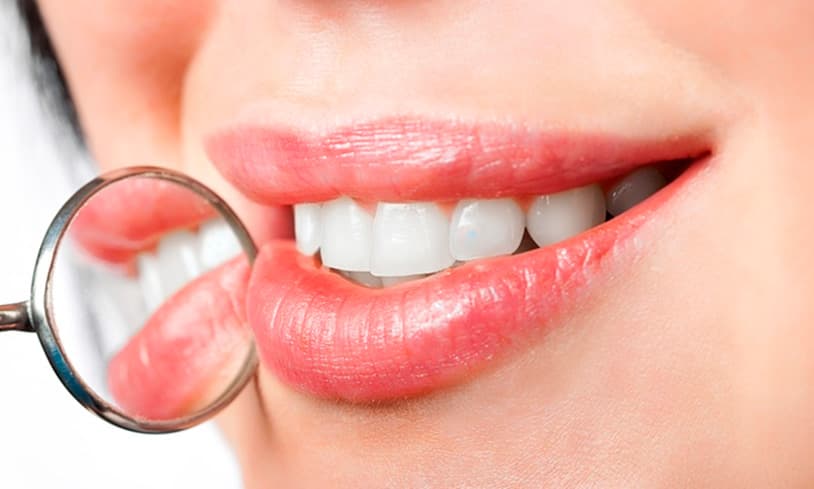 Per un sorriso bello e sano, approfitta della procedura per ablazione del tartaro nella clinica dentale Grand Turismo Dentale