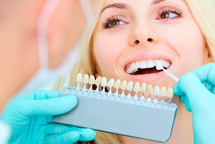 Vantaggi delle faccette dalla clinica clinica Grand Turismo Dentale in Moldavia- i denti più bianchi e regolari; allineamento di denti erosi; lucidità dello smalto; correzioni della spaziatura tra un dente e l’altro.
